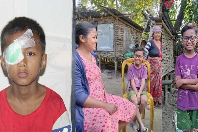 जन्मजात मोतिबिन्दु भएका १० वर्षीय सागरको निःशुल्क शल्यक्रिया,  फेरियो दैनिकी